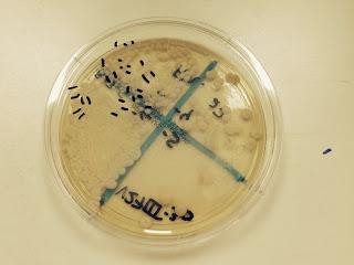 La Mastitis ¿qué es?. Mi práctica en la Universidad Complutense. La Mastitis ¿qué es?. Mi práctica en la Universidad Complutense.