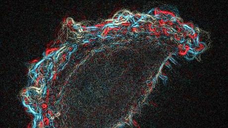 Nuevo avance médico ayudará a diseñar fármacos menos tóxicos para tratar cáncer Nuevo avance médico ayudará a diseñar fármacos menos tóxicos para tratar cáncer