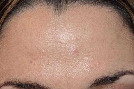 FACE FINITY (3IN1) FACE FINITY (3IN1)