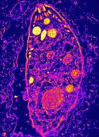 Elige bien a tu comensal... hoy con toxoplasma gondii Elige bien a tu comensal... hoy con toxoplasma gondii