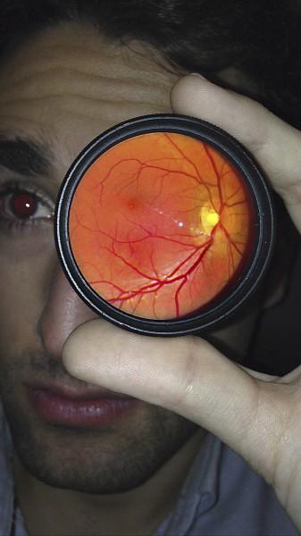 Autoexplorando el interior del ojo con el móvil Autoexploración retina