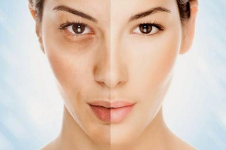 Tratamientos antienvejecimiento que sí funcionan Tratamientos antienvejecimiento que sí funcionan