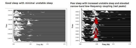 SleepImage, wearable para tratar la apnea del sueño