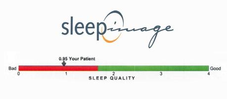 SleepImage, wearable para tratar la apnea del sueño