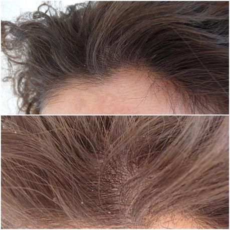¿Un producto sorprendentemente bueno para las descamaciones o pura casualidad? Mascarilla Exfoliante Stylus de Deliplus ¿Un producto sorprendentemente bueno para las descamaciones o pura casualidad? Mascarilla Exfoliante Stylus de Deliplus