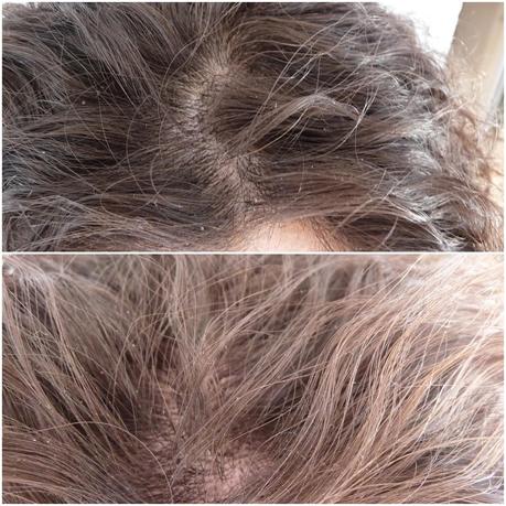 ¿Un producto sorprendentemente bueno para las descamaciones o pura casualidad? Mascarilla Exfoliante Stylus de Deliplus ¿Un producto sorprendentemente bueno para las descamaciones o pura casualidad? Mascarilla Exfoliante Stylus de Deliplus