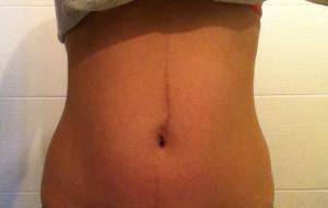 Tripa después del parto tripa después parto