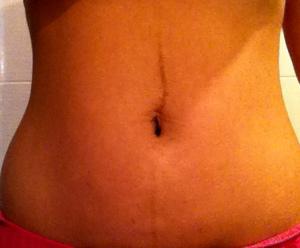 Tripa después del parto tripa después del parto