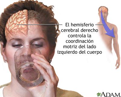 El hemisferio derecho controla la parte izquierda del cuerpo.