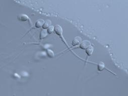 ¿Qué es la IMSI? foto imsi