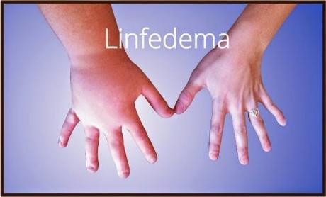 ¿Qué es el Linfedema?