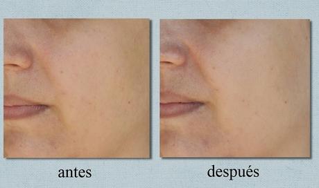 La mascarilla facial “Maskream Matificante” de ISDIN en FARMA INSTANT La mascarilla facial “Maskream Matificante” de ISDIN en FARMA INSTANT