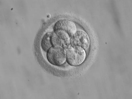 ¿Qué dice la Ley Española sobre el destino de los embriones humanos congelados tras un ciclo de FIV?