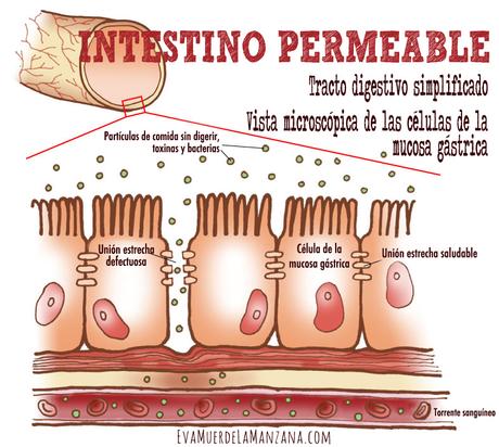 Diagrama permeabilidad intestinal aumentada
