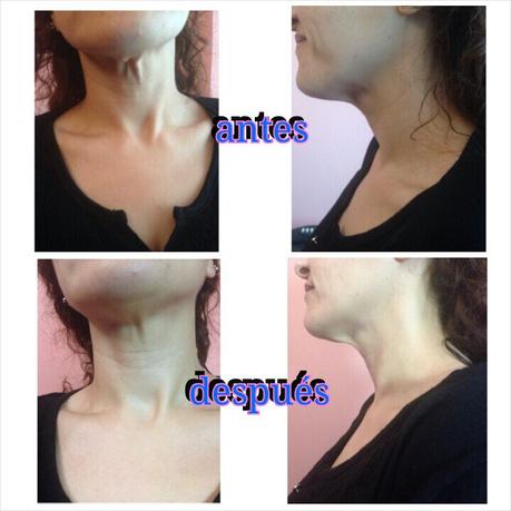 Parches de it works facial Parches de it works facial