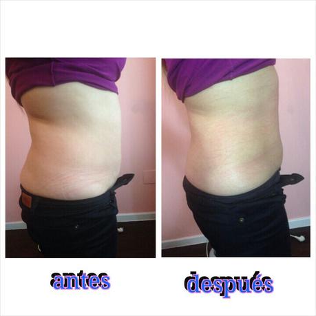 Parches de it works corporal Parches de it works corporal