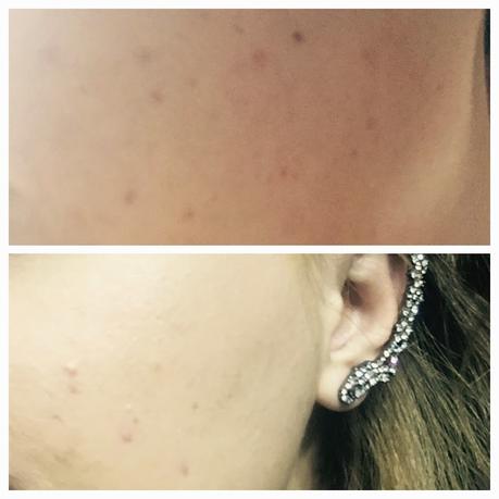 La Roche Posay Effaclar Serum La Roche Posay Effaclar Serum