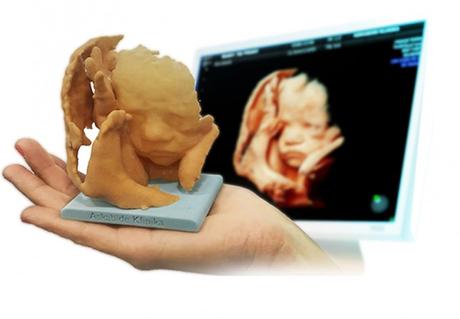 Baby3DPrint Ecografía impresa en 3D