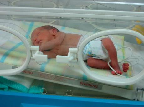 Algoritmo para estabilizar la temperatura de los bebés prematuros en la incubadora Temperatura corporal de los bebés prematuros