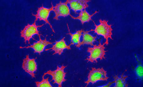 Un nuevo tipo de células madre da otra oportunidad a los órganos de reemplazo