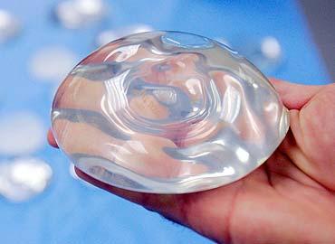 TURISMO DEL BISTURÍ : VACACIONES CON LIPOSUCCIÓN INCLUIDAS. TURISMO DEL BISTURÍ : VACACIONES CON LIPOSUCCIÓN INCLUIDAS.