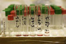 EEUU: Crean en un laboratorio tejido hepático funcional