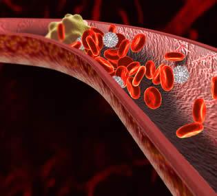 Importancia de una Dieta Baja en Colesterol para tu Salud Importancia de una Dieta Baja en Colesterol para tu Salud