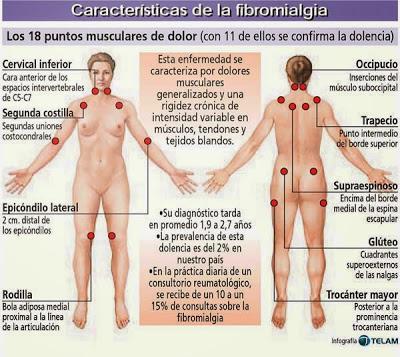 LA FIBROMIALGIA, YO Y MAS INTRUSOS. LA FIBROMIALGIA, YO Y MAS INTRUSOS.
