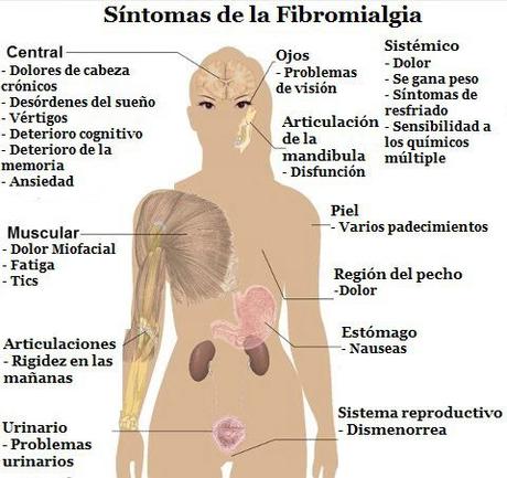 Hola, tengo Fibromialgia