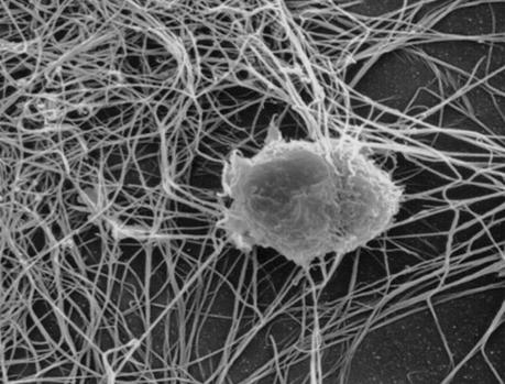 La célula dendrítica. Fuente Wikipedia