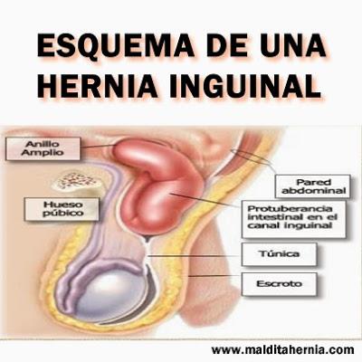 Como quitar el hongo de las uñas de la mano