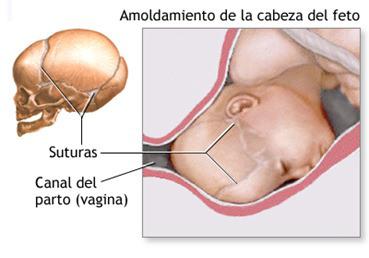 Fontanelas y costra láctea Fontanelas y costra láctea
