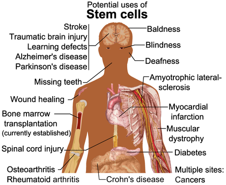 Logran obtener células nerviosas a partir de sangre. Stem cell treatments.png