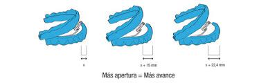 TRATAMIENTOS DEL RONQUIDO Y LA APNEA DEL SUEÑO