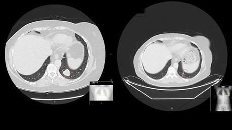 Presentan un revolucionario tratamiento biotecnológico contra varios tipos de cáncer Presentan un revolucionario tratamiento biotecnológico contra varios tipos de cáncer