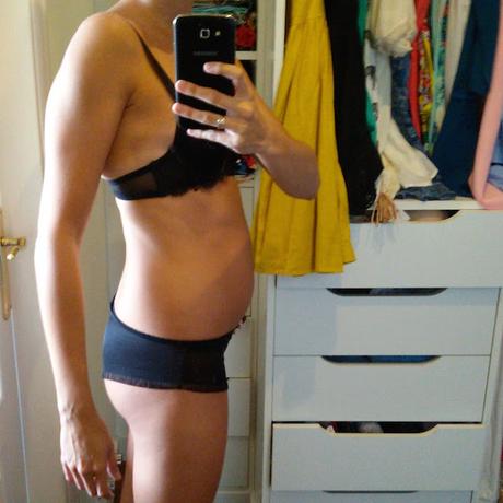 Post-parto / Postpartum Post-parto / Postpartum