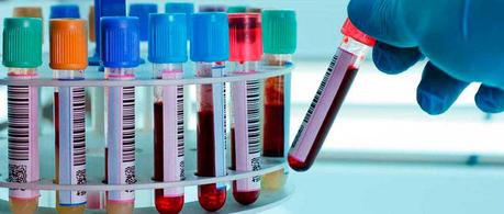 Un análisis de sangre permitirá descubrir todos los virus que han afectado a una persona