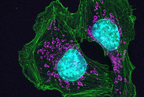 Un virus hackea las defensas para que combatan el cáncer Un virus hackea las defensas para que combatan el cáncer