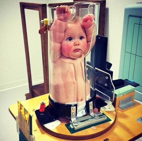 Radiografías en bebés