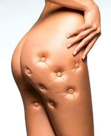 Tips Caseros Efectivos Para Eliminar La Celulitis Tips Caseros Efectivos Para Eliminar La Celulitis