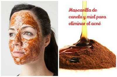 Mascarilla de canela y miel para eliminar el acné