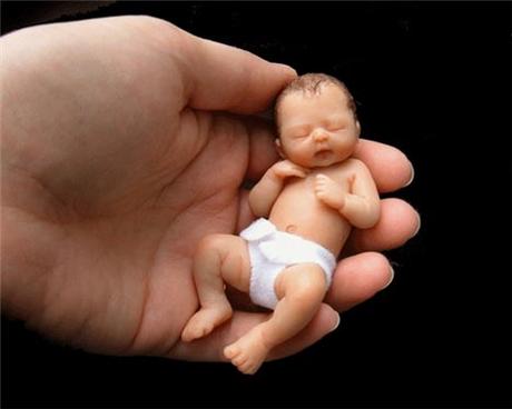 SUPERVIVENCIA DE NIÑOS EXTREMADAMENTE PREMATUROS SUPERVIVENCIA DE NIÑOS EXTREMADAMENTE PREMATUROS