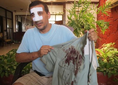  Antonio Rodiles le relata a CubaNet  sobre su detención y la golpiza a la que fue sometido (foto de Ernesto García)