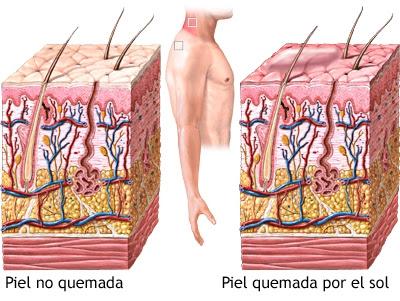 AFTER SUN. Un Básico Para el Verano AFTER SUN. Un Básico Para el Verano