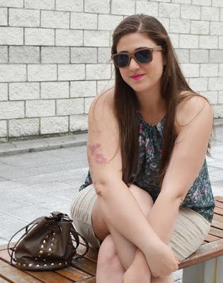 Outfit of the Day ~ Bermudas, Bermudas everywhere Outfit of the Day ~ Bermudas, Bermudas everywhere