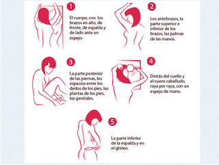 Cáncer de piel en los niños: cómo reconocer el melanoma Cáncer de piel en los niños: cómo reconocer el melanoma