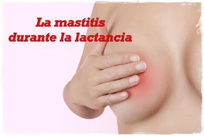 Las mastitis durante la lactancia