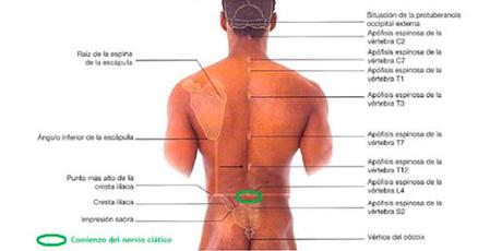 Despues de leer esto te olvidaras del dolor de la ciática Despues de leer esto te olvidaras del dolor de la ciática