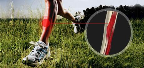 ¿Qué es el micro trauma? microtrauma Artricenter 3