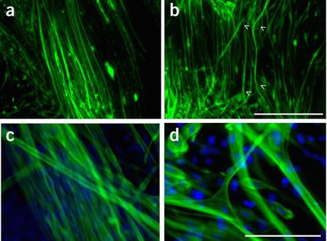 Fibras musculares cultivadas en el laboratorio ofrecen nuevo modelo para la distrofia muscular de Ducchene Fibras musculares celular madre